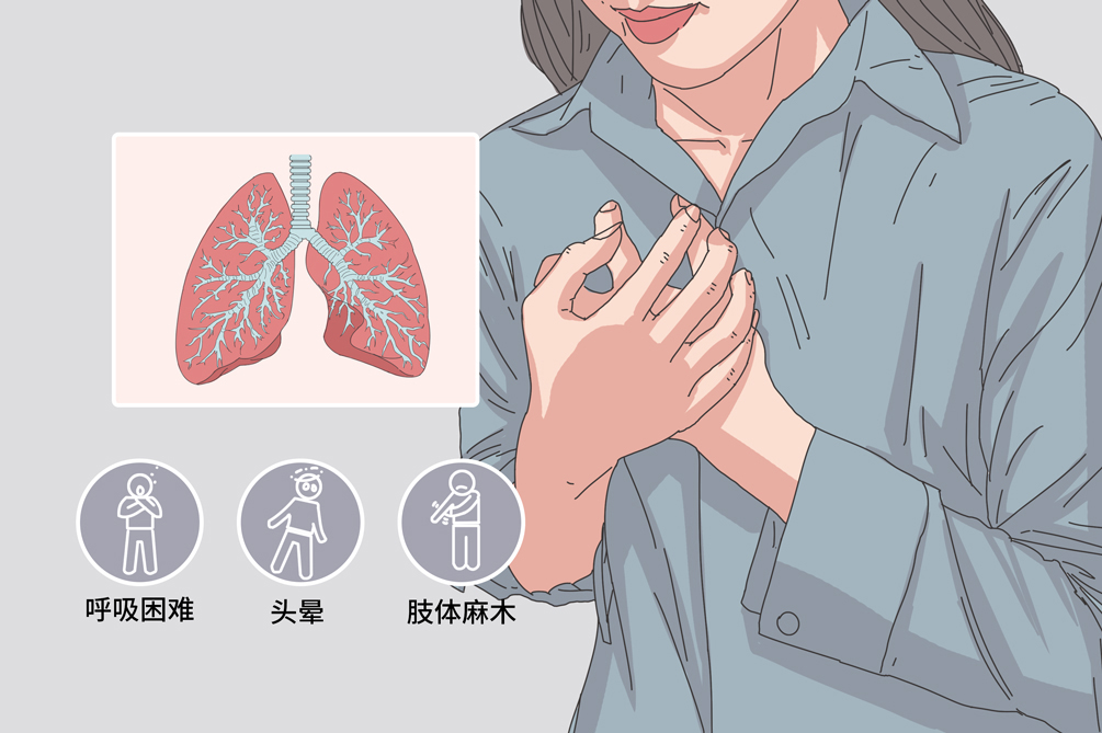 过度通气综合征