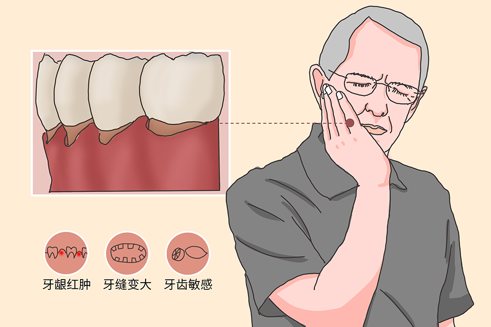 牙龈萎缩