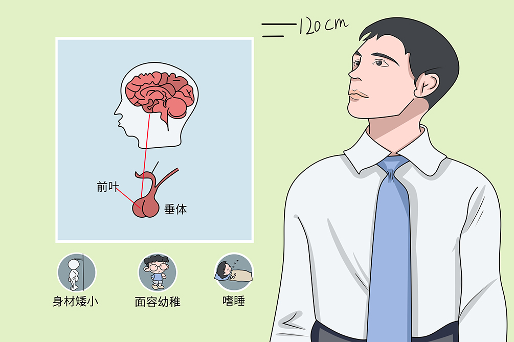 生长激素缺乏症