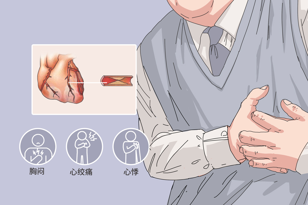 不稳定型心绞痛