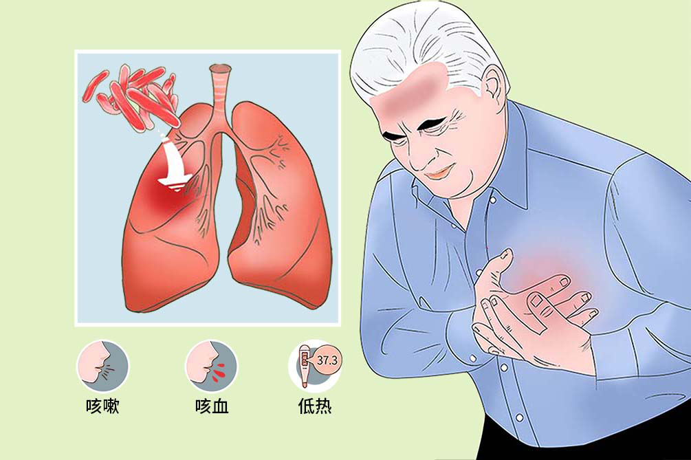 肺结核