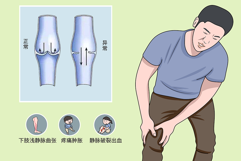 原发性下肢深静脉瓣膜关闭不全