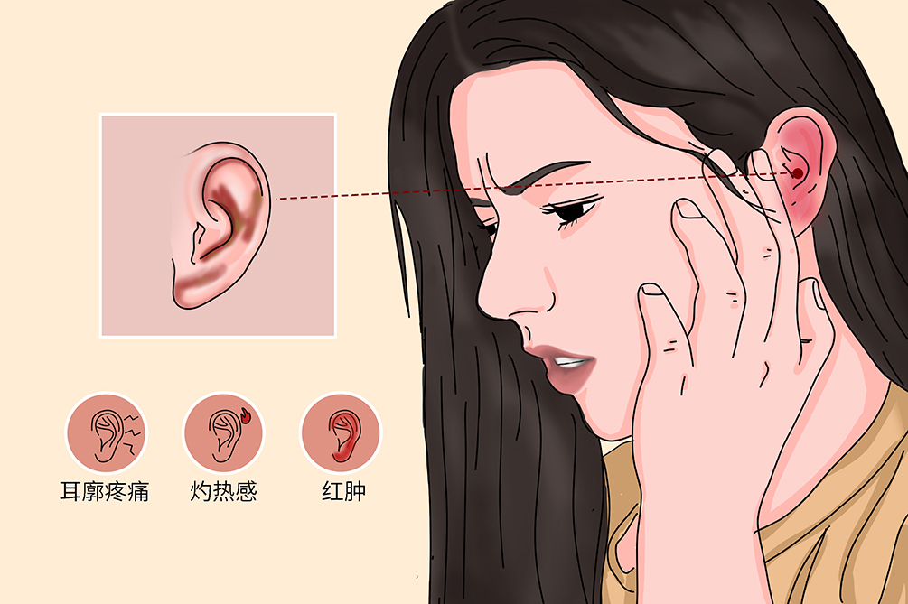 耳廓化脓性软骨膜炎