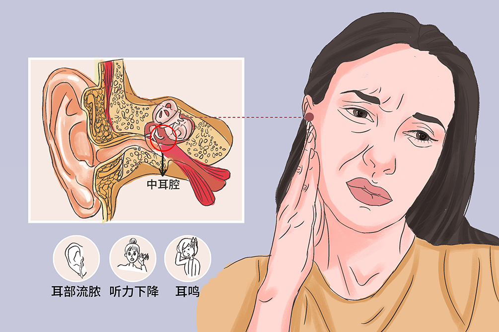 慢性化脓性中耳炎