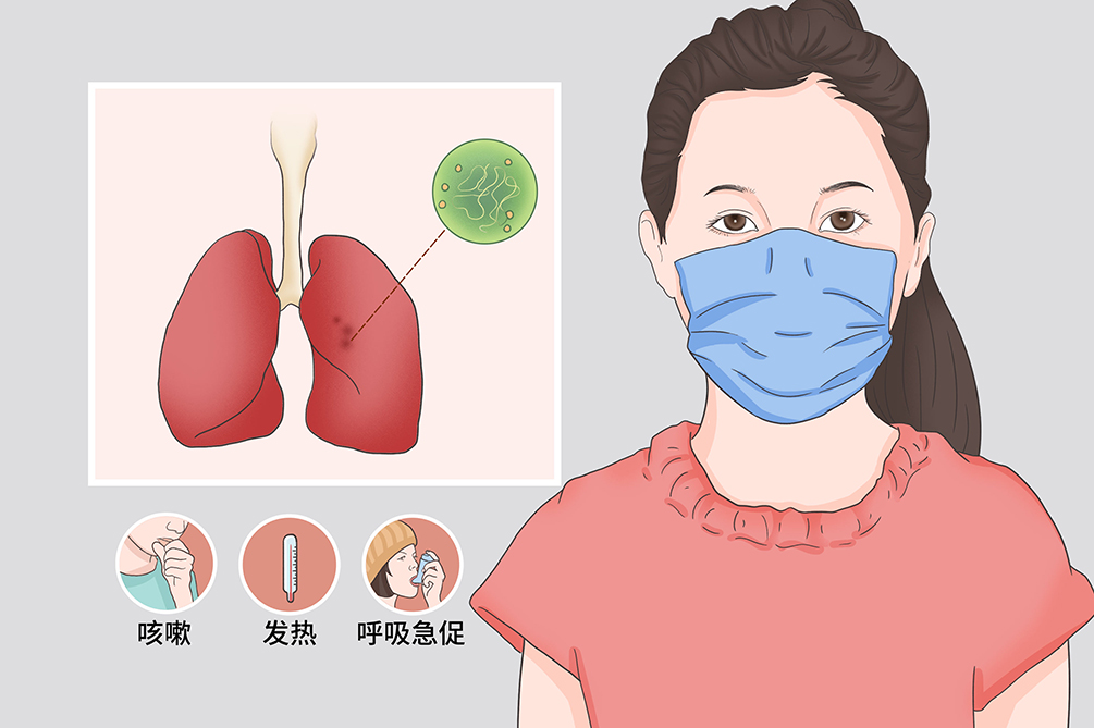 小儿肺炎支原体肺炎