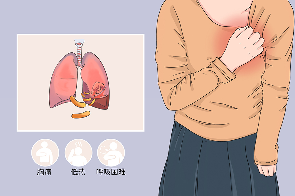 结核性胸膜炎