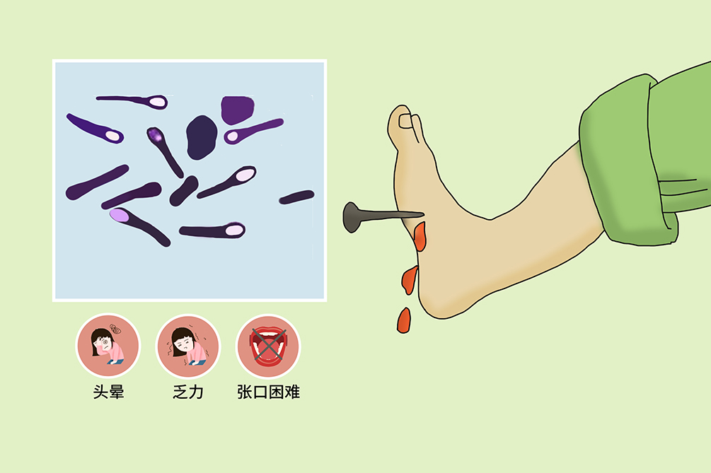 破伤风