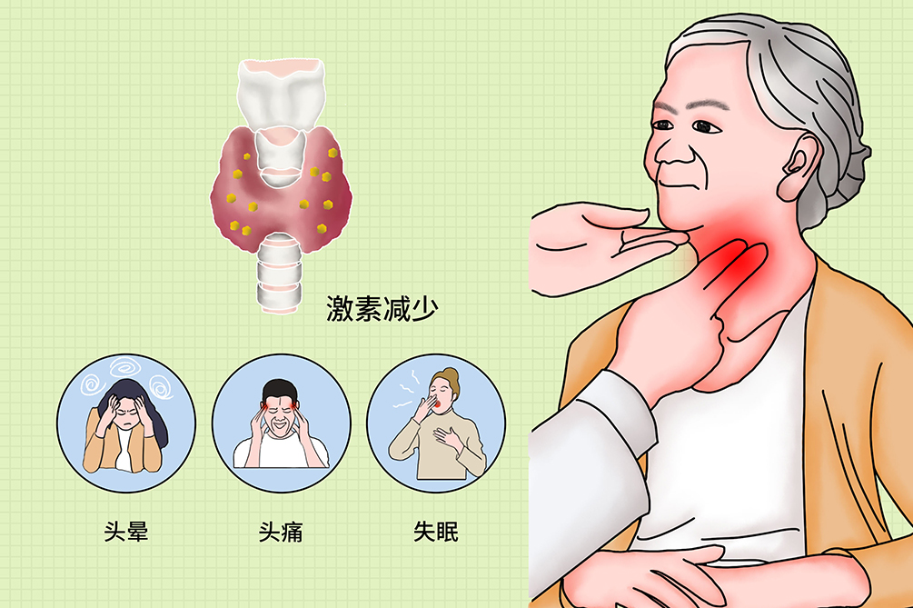 甲状旁腺功能减退症