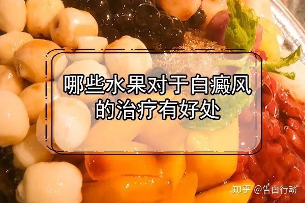 患上白癜风后饮食上注意什么