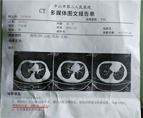 肺结核的确诊方法