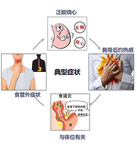 化脓性食管炎严重吗怎么治疗