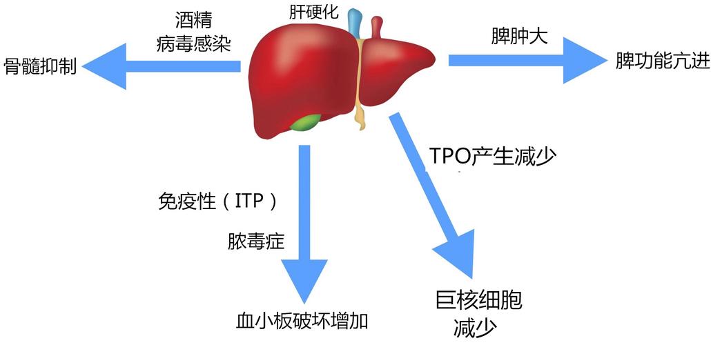 肝硬化出血的原因