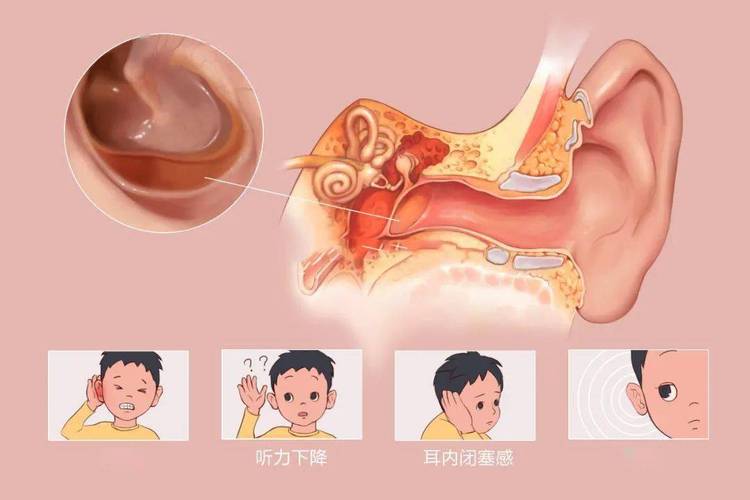 儿子头疼+有中耳炎