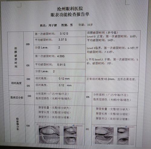 眼科基本检查干眼症