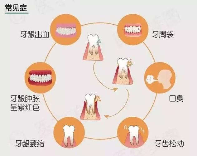 小孩血友病掉牙了出血怎么办