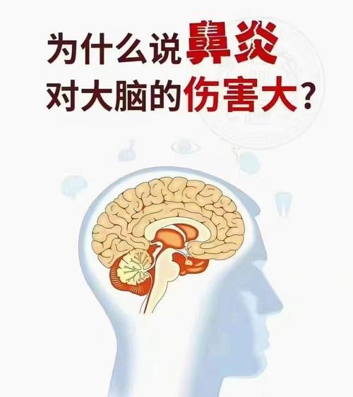 鼻窦炎嗜酸粒细胞高