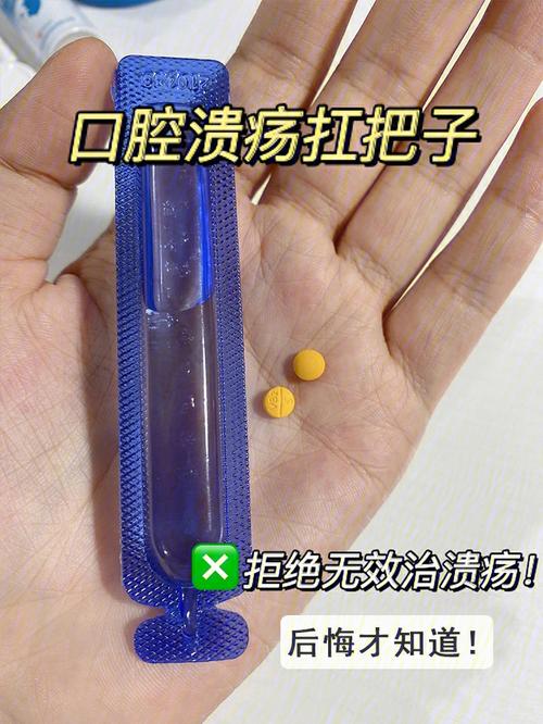 感冒关节痛口腔溃疡