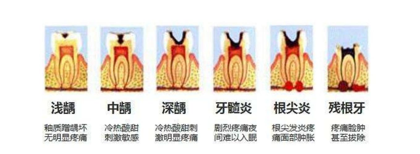 牙髓炎症状但不确定是哪只牙