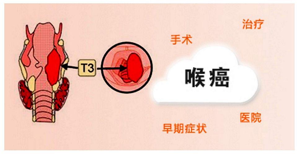 声音嘶哑是喉癌吗