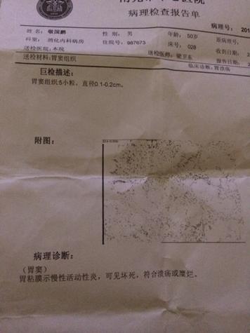 多大的胃溃疡可以保守治疗