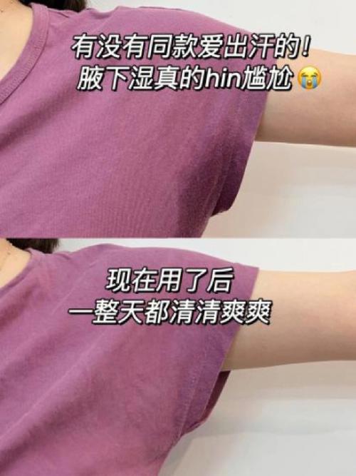 腋窝易出汗不是狐臭