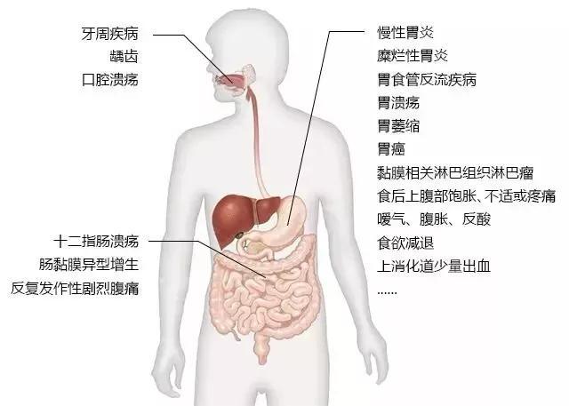 反复口腔溃疡会有胃溃疡吗