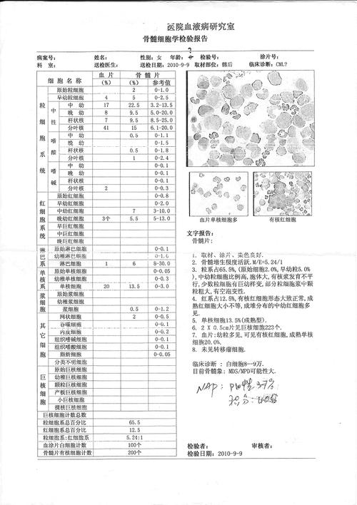 慢性淋巴细胞白血病的检查