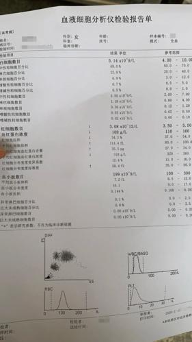 慢性淋巴细胞白血病的检查