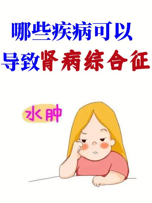 得了肾病综合征能不能上班