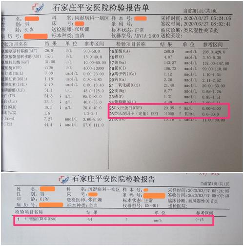 验血单类风湿因子正常偏低