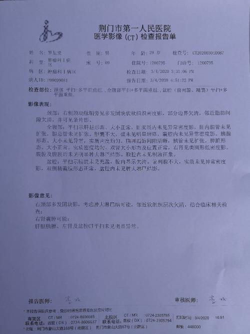 增强ct可以判断淋巴癌吗