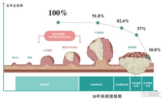 管状腺瘤一级直肠癌进展期