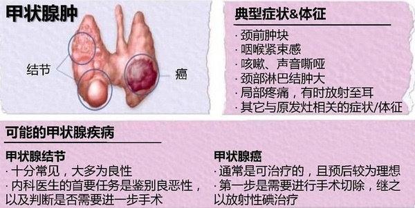 甲状腺癌不列为癌症