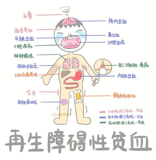 增生性贫血和再生障碍贫血