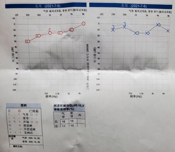 肺癌晚期听力怎么越来越差