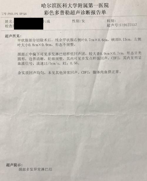 甲状腺癌单细胞测序