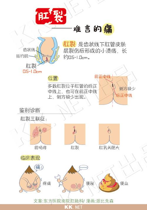 大便拉不出来痢疾怎么办