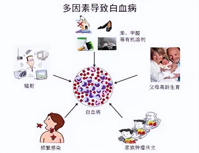 怎么样会得白血病白血病