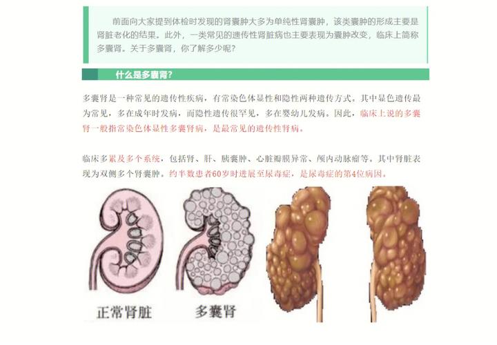 动物多囊肾病的症状表现