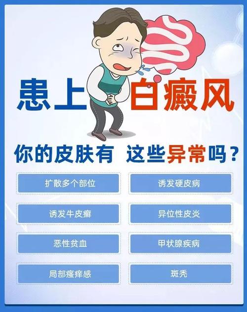 老年人白癜风原因是什么