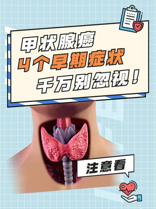 甲状腺癌不能同床吗