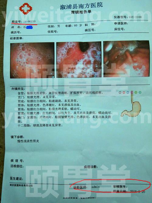 多发性胃溃疡息肉大便青色