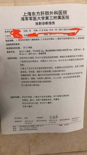 增强ct怎么判断淋巴癌