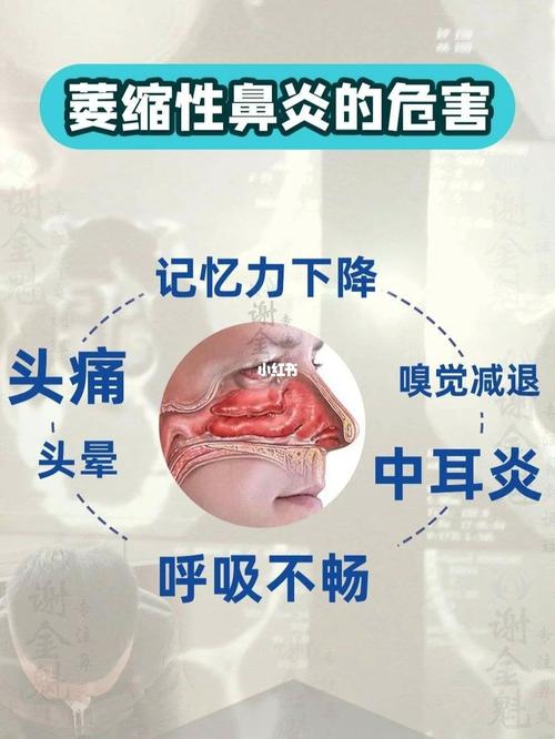 不知道是鼻炎还是感冒怎么办