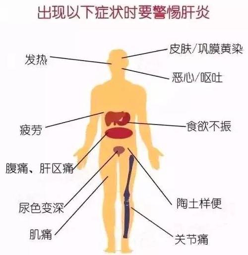 丙型肝炎的症状有哪些