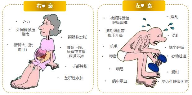 充血性心力衰竭应该如何预防