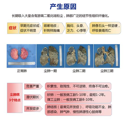 尘肺与肺癌有什么关系吗