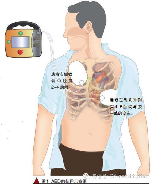 37岁男有房颤怎么办？