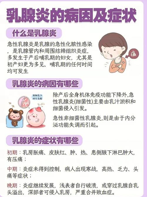 产褥期乳腺炎应该如何预防