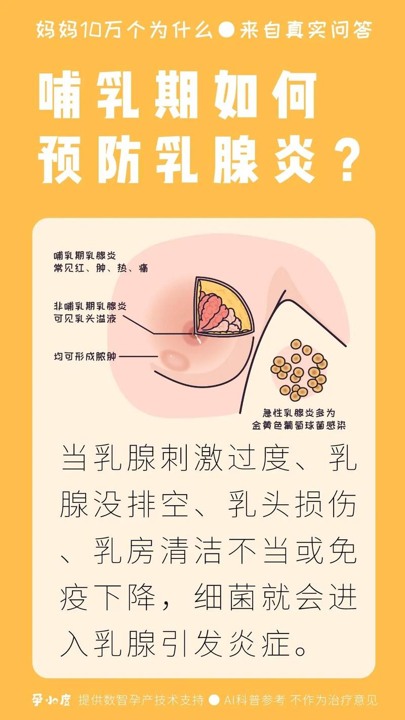 产褥期乳腺炎应该如何预防